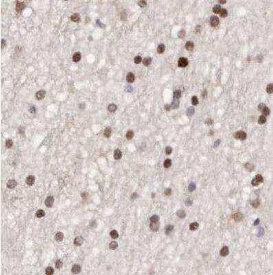 Immunohistochemistry-Paraffin: Transketolase Antibody [NBP1-87441] - Staining of human cerebral cortex using Anti-TKT antibody.