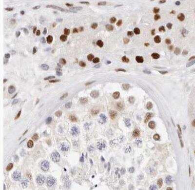 Immunohistochemistry-Paraffin: Transketolase Antibody [NBP1-87441] - Staining of human testis using Anti-TKT antibody.