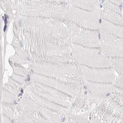 Immunohistochemistry-Paraffin: Transketolase Antibody [NBP1-87441] - Staining of human skeletal muscle using Anti-TKT antibody NBP1-87441.