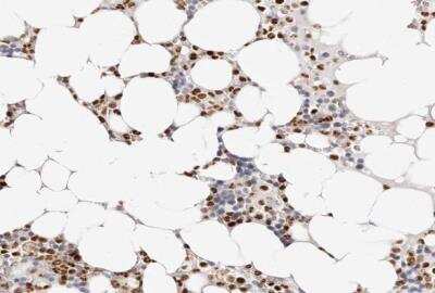 Immunohistochemistry-Paraffin: Transketolase Antibody [NBP1-87441] - Staining of human bone marrow shows high expression.