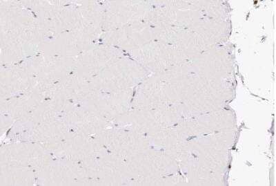 Immunohistochemistry-Paraffin: Transketolase Antibody [NBP1-87441] - Staining of human skeletal muscle shows low expression as expected.