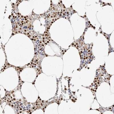 Immunohistochemistry-Paraffin: Transketolase Antibody [NBP1-87442] - Staining of human bone marrow shows high expression.