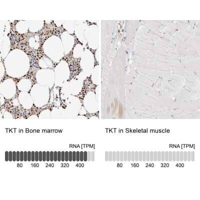 <b>Orthogonal Strategies Validation. </b>Immunohistochemistry-Paraffin: Transketolase Antibody [NBP1-87442] - Staining in human bone marrow and skeletal muscle tissues using anti-TKT antibody. Corresponding TKT RNA-seq data are presented for the same tissues.