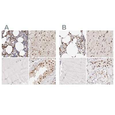 <b>Independent Antibodies Validation. </b>Immunohistochemistry-Paraffin: Transketolase Antibody [NBP1-87442] - Staining of human bone marrow, cerebral cortex, skeletal muscle and testis using Anti-TKT antibody NBP1-87442 (A) shows similar protein distribution across tissues to independent antibody NBP1-87441 (B).