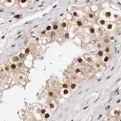 Immunohistochemistry-Paraffin: Transketolase Antibody [NBP1-87442] - Staining of human testis.