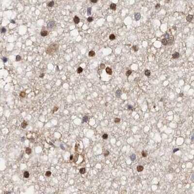 Immunohistochemistry-Paraffin: Transketolase Antibody [NBP1-87442] - Staining of human cerebral cortex.