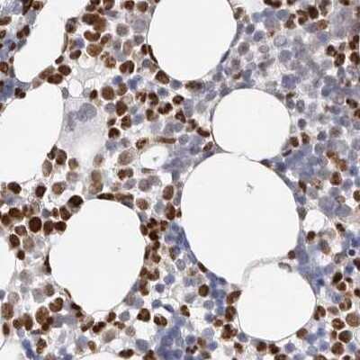 Immunohistochemistry-Paraffin: Transketolase Antibody [NBP1-87442] - Staining of human bone marrow using Anti-TKT antibody NBP1-87442.