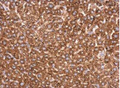 Immunohistochemistry-Paraffin: Transketolase Antibody [NBP2-20699] - Paraffin-embedded mouse liver.  Transketolase antibody [N3C2], Internal diluted at 1:500.