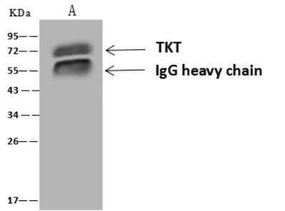 Immunoprecipitation: Transketolase Antibody [NBP3-12646] - Lane A:0.5 mg HeLa Whole Cell Lysate4 uL anti-TKT rabbit polyclonal antibody and 60 ug of Immunomagnetic beads Protein A/G.Primary antibody:Anti-TKT rabbit polyclonal antibody,at 1:100 dilution Secondary antibody:Goat Anti-Rabbit IgG (H+L)/HRP at 1/10000 dilutionDeveloped using the ECL technique.Performed under reducing conditions.Predicted band size: 68 kDaObserved band size :68 kDa