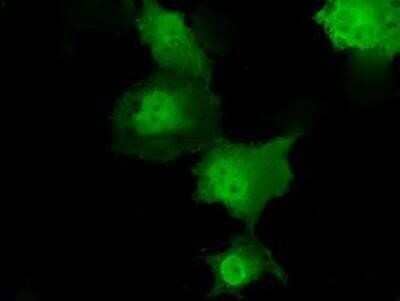 Immunocytochemistry/Immunofluorescence: Transketolase Antibody (OTI5H3) - Azide and BSA Free [NBP2-74585] - Staining of COS7 cells transiently transfected by pCMV6-ENTRY Transketolase.