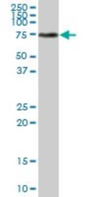 Western Blot: Transketolase Antibody [H00007086-B01P] - Analysis of TKT expression in human pancreas.