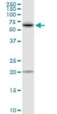 Western Blot: Transketolase Antibody [H00007086-D01P] - Analysis of TKT expression in Jurkat.