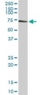 Western Blot: Transketolase Antibody [H00007086-D01P] - Analysis of TKT expression in human pancreas.
