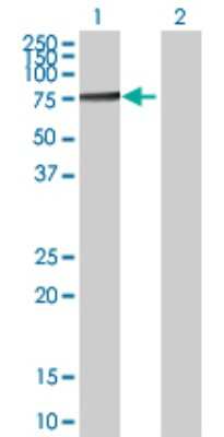 Western Blot: Transketolase Antibody [H00007086-D01P] - Analysis of TKT expression in transfected 293T cell line by TKT polyclonal antibody.Lane 1: TKT transfected lysate(67.90 KDa).Lane 2: Non-transfected lysate.