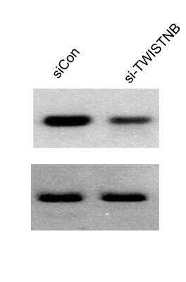 Western Blot: Transketolase Antibody [NBP1-87441] - Analysis of 293T cells lysate after siren treatment with siTWISTNB and siControl Transketolase. Image submitted by a verified customer review. 