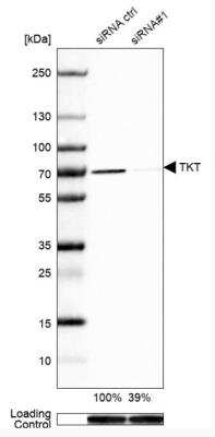 <b>Genetic Strategies Validation. </b>Western Blot: Transketolase Antibody [NBP1-87441] - Analysis in A-549 cells transfected with control siRNA, target specific siRNA probe #1, using Anti-TKT antibody. Remaining relative intensity is presented. Loading control: Anti-GAPDH.