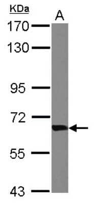 Western Blot: Transketolase Antibody [NBP2-20699] - Sample (30 ug of whole cell lysate) A: Raji 7. 5% SDS PAGE gel, diluted at 1:1000.