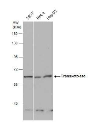 Western Blot: Transketolase Antibody [NBP2-20699] - Various whole cell extracts (30 ug) were separated by 7.5% SDS-PAGE, and the membrane was blotted with Transketolase antibody [N3C2], Internal diluted at 1:1000.