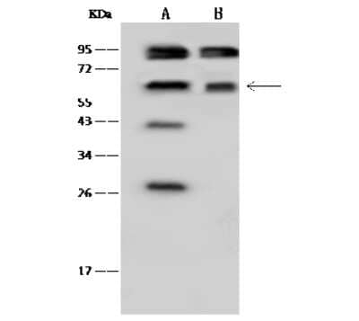 Western Blot: Transketolase Antibody [NBP2-99344] - Anti-Transketolase rabbit polyclonal antibody at 1:500 dilution. Lane A: HepG2 Whole Cell Lysate Lane B: HeLa Whole Cell Lysate Lysates/proteins at 30 ug per lane. Secondary Goat Anti-Rabbit IgG (H+L)/HRP at 1/10000 dilution. Developed using the ECL technique. Performed under reducing conditions. Predicted band size: 68 kDa. Observed band size: 68 kDa (We are unsure as to the identity of these extra bands).