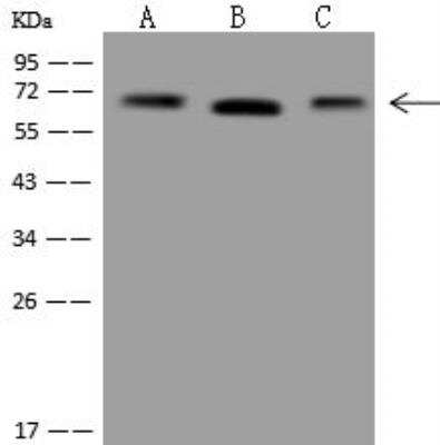 Western Blot: Transketolase Antibody [NBP3-12646] - Lane A: HepG2 Whole Cell LysateLane B: HeLa Whole Cell LysateLane C: Raji Whole Cell LysateLysates/proteins at 30 ug per lane.SecondaryGoat Anti-Rabbit IgG (H+L)/HRP at 1/10000 dilution.Developed using the ECL technique.Performed under reducing conditions.Predicted band size:68 kDaObserved band size:70 kDa