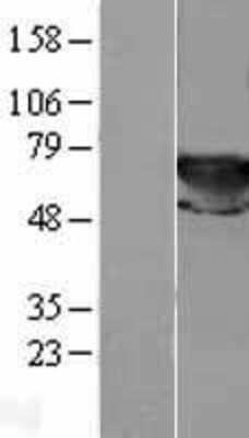 Western Blot: Transketolase Overexpression Lysate (Adult Normal) [NBL1-16940] Left-Empty vector transfected control cell lysate (HEK293 cell lysate); Right -Over-expression Lysate for Transketolase.