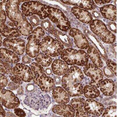 Immunohistochemistry-Paraffin: TMEM160 Antibody [NBP2-30449] - Transmembrane Protein 160 Antibody [NBP2-30449] - Staining of human kidney shows strong cytoplasmic positivity in cells in tubules.