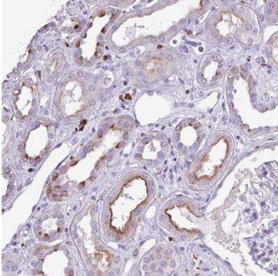 Immunohistochemistry: Transmembrane Protein 200C Antibody [NBP2-30818] - Staining of human kidney shows strong cytoplasmic and membranous positivity in subset of cells in renal tubules.