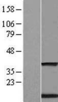 Western Blot: Transmembrane protein 59 Overexpression Lysate (Adult Normal) [NBL1-17093] Left-Empty vector transfected control cell lysate (HEK293 cell lysate); Right -Over-expression Lysate for Transmembrane protein 59.