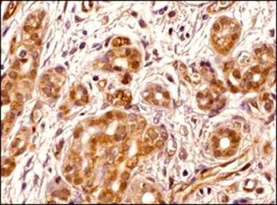 Immunohistochemistry-Paraffin: Transportin 1 Antibody (D45) - Azide and BSA Free [NBP2-80991] - IHC analysis of a formalin fixed paraffin embedded tissue section of human pancreas using Transportin 1 antibody (clone D45) at 1:200 dilution. The antibody generated specific nuclear and cytoplasmic signal of Transportin 1 protein in the glandular cells