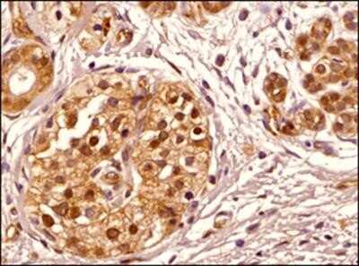 Immunohistochemistry-Paraffin: Transportin 1 Antibody (D45) - Azide and BSA Free [NBP2-80991] - IHC analysis of a formalin fixed paraffin embedded tissue section of human pancreas using Transportin 1 antibody (clone D45) at 1:200 dilution. The antibody generated specific nuclear and cytoplasmic signal of Transportin 1 protein in the glandular cells