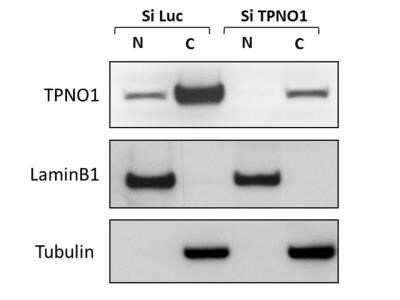 Western Blot: Transportin 1 Antibody (D45) - Azide and BSA Free [NBP2-80991] - Human lung cancer cell line usig lysates from HCC44 cell line. (N: Nuclear fraction, C: Cytoplasmic fraction). Image from verified customer review. Image from the standard format of this antibody.