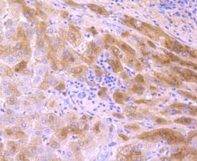 Immunohistochemistry-Paraffin: Transthyretin/Prealbumin Antibody (JF1016) [NBP2-67226] - Analysis of paraffin-embedded human liver tissue using anti-Prealbumin antibody. Counter stained with hematoxylin.