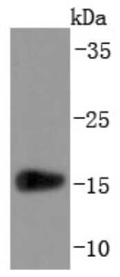 Western Blot: Transthyretin/Prealbumin Antibody (JF1016) [NBP2-67226] - Analysis of Prealbumin on human lung lysates using anti-Prealbumin antibody at 1/1,000 dilution.