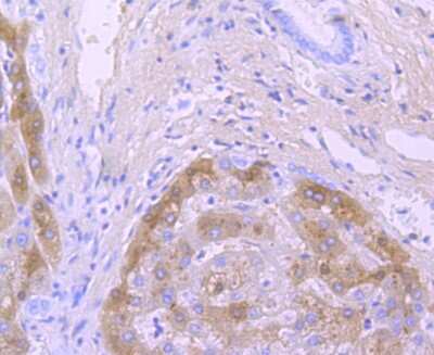 Immunohistochemistry-Paraffin: Transthyretin/Prealbumin Antibody (JM11-43) [NBP2-67227] - Analysis of paraffin-embedded human liver tissue using anti- TTR antibody. Counter stained with hematoxylin.