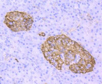 Immunohistochemistry-Paraffin: Transthyretin/Prealbumin Antibody (JM11-43) [NBP2-67227] - Analysis of paraffin-embedded human pancreas tissue using anti-TTR antibody. Counter stained with hematoxylin.