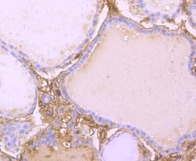 Immunohistochemistry-Paraffin: Transthyretin/Prealbumin Antibody (JM11-43) [NBP2-67227] - Analysis of paraffin-embedded human thyroid tissue using anti-TTR antibody. Counter stained with hematoxylin.
