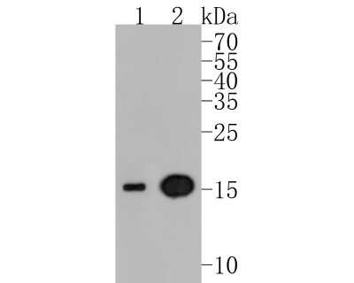 Western Blot: Transthyretin/Prealbumin Antibody (JM11-43) [NBP2-67227] - Western blot analysis of Transthyretin/Prealbumin on different lysates. Proteins were transferred to a PVDF membrane and blocked with 5% BSA in PBS for 1 hour at room temperature. The primary antibody (1/500) was used in 5% BSA at room temperature for 2 hours. Goat Anti-Rabbit IgG - HRP Secondary Antibody (HA1001) at 1:5,000 dilution was used for 1 hour at room temperature. Positive control: Lane 1: human liver tissue lysate Lane 2: human lung tissue lysate