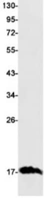 Western Blot: Transthyretin/Prealbumin Antibody (S07-4A2) [NBP3-19744] - Western blot detection of Transthyretin/Prealbumin in Rat Brain lysates using NBP3-19744 (1:1000 diluted). Predicted band size: 16kDa. Observed band size: 16kDa.