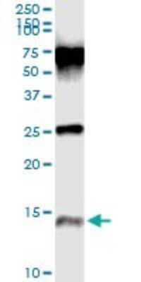 Immunoprecipitation: Trappin-2/Elafin/Skalp Antibody (2G20) [H00005266-M02] - Analysis of PI3 transfected lysate using anti-PI3 monoclonal antibody and Protein A Magnetic Bead, and immunoblotted with PI3 monoclonal antibody.