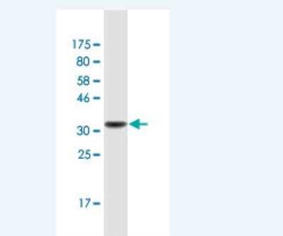 Western Blot: Trappin-2/Elafin/Skalp Antibody (3C4) [H00005266-M03] - Detection against Immunogen (38.61 KDa) .