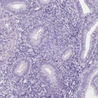 <b>Orthogonal Strategies Validation. </b>Immunohistochemistry-Paraffin: Trappin-2/Elafin/Skalp Antibody [NBP1-85690] - Staining of human endometrium shows no positivity in glandular cells as expected.