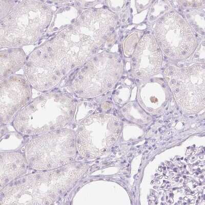 Immunohistochemistry-Paraffin: Trappin-2/Elafin/Skalp Antibody [NBP1-85690] - Staining of human kidney shows no positivity in cells in tubules as expected.