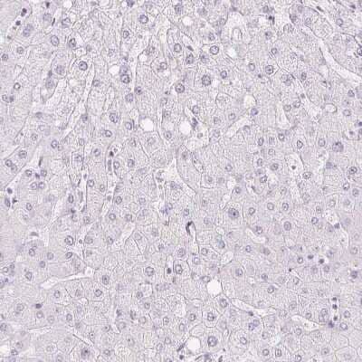 Immunohistochemistry-Paraffin: Trappin-2/Elafin/Skalp Antibody [NBP1-85690] - Staining of human liver shows no positivity in hepatocytes as expected.