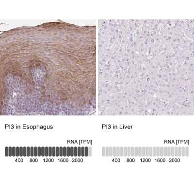 Immunohistochemistry-Paraffin: Trappin-2/Elafin/Skalp Antibody [NBP1-85690] - Staining in human esophagus and liver tissues using NBP1-85690 antibody. Corresponding PI3 RNA-seq data are presented for the same tissues.