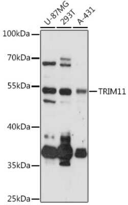 Western Blot: Trim11 Antibody [NBP2-94733] - Analysis of extracts of various cell lines, using Trim11 at 1:3000 dilution. Secondary antibody: HRP Goat Anti-Rabbit IgG (H+L) at 1:10000 dilution. Lysates/proteins: 25ug per lane. Blocking buffer: 3% nonfat dry milk in TBST. Detection: ECL Basic Kit . Exposure time: 90s.
