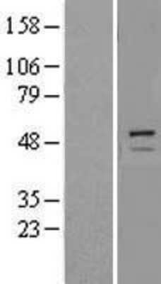 Western Blot: Trim11 Overexpression Lysate (Adult Normal) [NBL1-17275] Left-Empty vector transfected control cell lysate (HEK293 cell lysate); Right -Over-expression Lysate for Trim11.