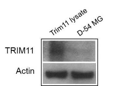 Western Blot: Trim11 Overexpression Lysate (Native) [NBL1-17275] - analysis of Trim 11 expression. Image from verified customer review.  