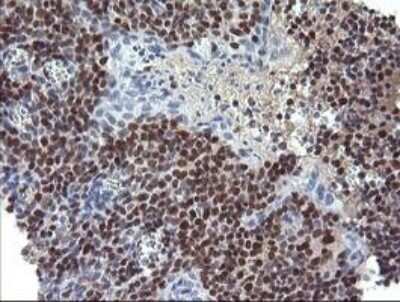 Immunohistochemistry: Trim22 Antibody (OTI1D11) - Azide and BSA Free [NBP2-74608] - Analysis of Human tonsil tissue. (Heat-induced epitope retrieval by 10mM citric buffer, pH6.0, 120C for 3min)