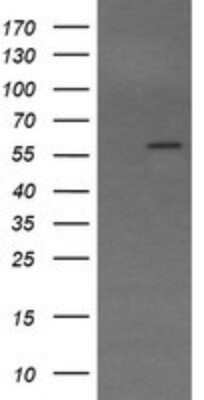 Western Blot: Trim22 Antibody (OTI1D11) - Azide and BSA Free [NBP2-74608] - Analysis of HEK293T cells were transfected with the pCMV6-ENTRY control (Left lane) or pCMV6-ENTRY TRIM22.