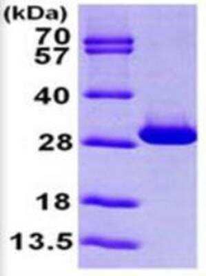 SDS-Page: Triosephosphate isomerase Protein [NBP1-49451] - 15% SDS-PAGE (3 ug).